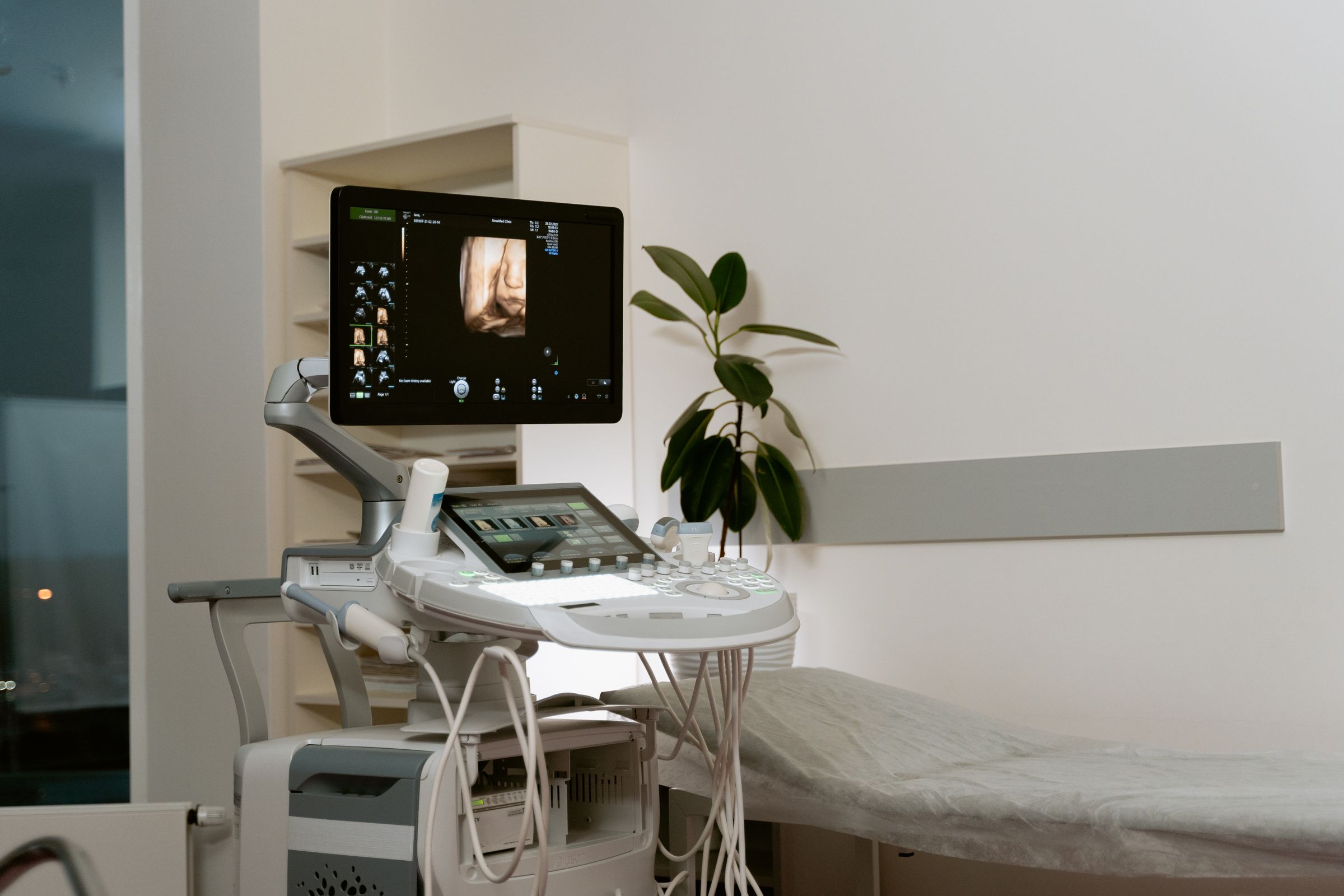 Sistema de ultrasonido instalado junto a una camilla en un consultorio