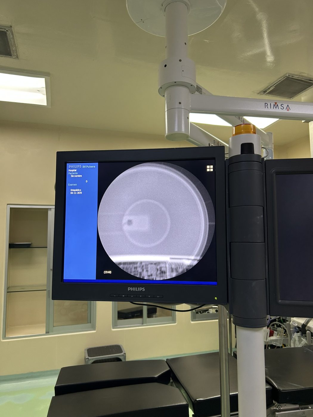 Monitor del arco en C Philips BV Endura mostrando una imagen de adquisición durante el ajuste del iris