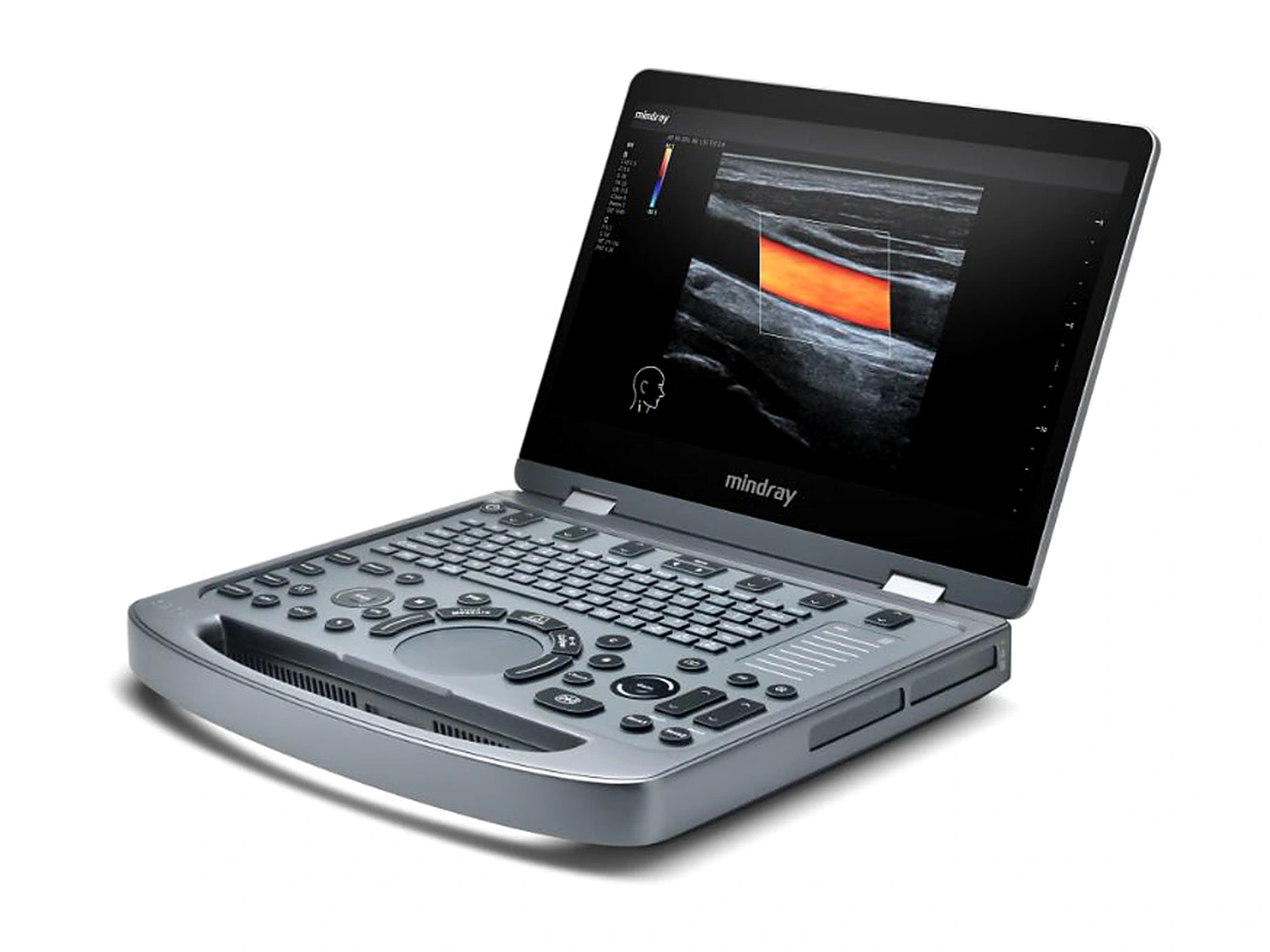Ultrasonido compacto Mindray MX3 tipo laptop abierto, con imagen Doppler color en pantalla