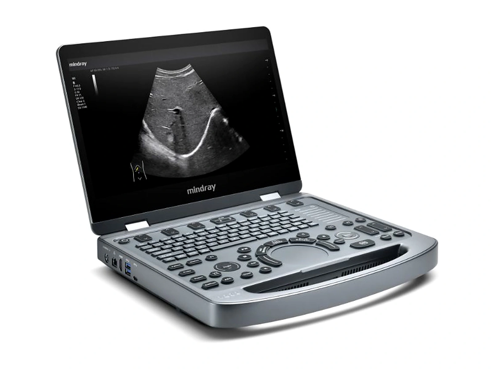Ultrasonido compacto Mindray MX5 tipo laptop abierto, con imagen en escala de grises en pantalla