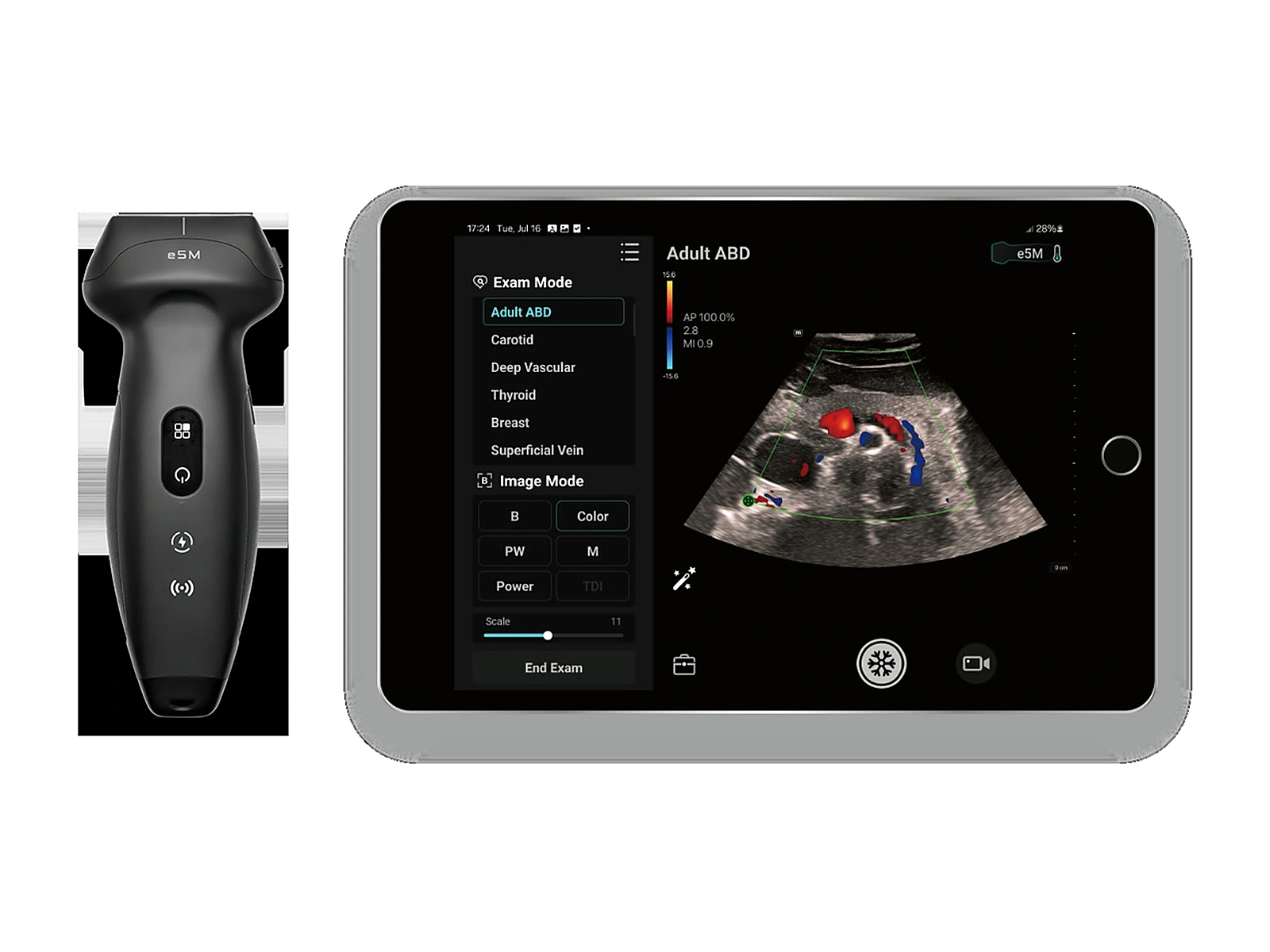 Transductor inalámbrico Mindray TE Air e5M junto a una tableta con un estudio abdominal en Doppler color